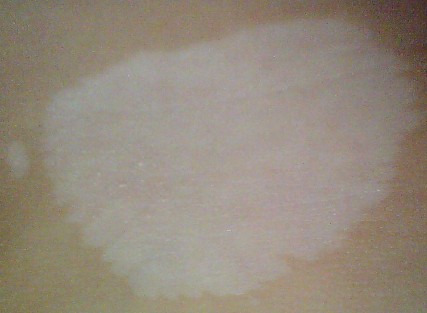 白点癜风喝绿豆汤管用吗.jpg